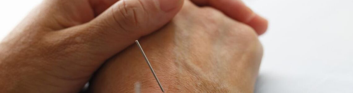 Is Acupuncture a Safer Alternative to Painkillers?