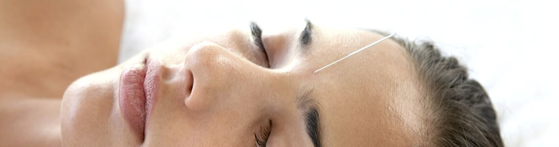8 Reasons to Try Facial Acupuncture